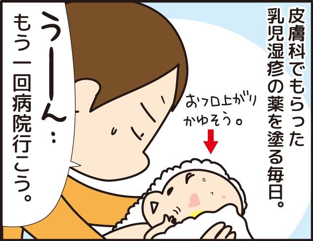 亜鉛 華 軟膏 赤ちゃん 顔