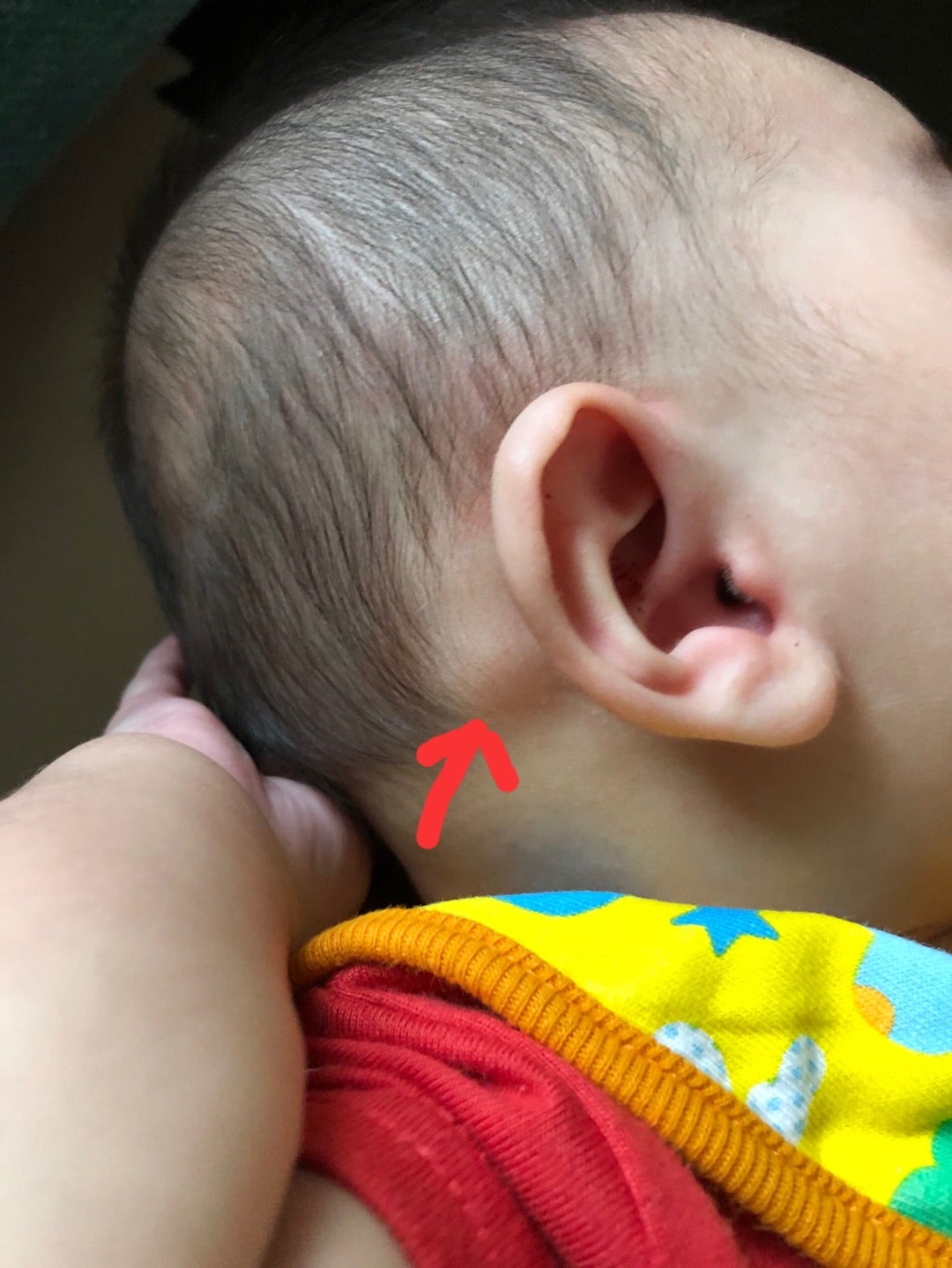 赤ちゃん 耳 の 後ろ 赤い