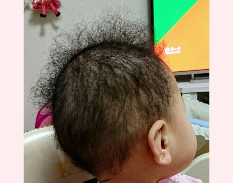 赤ちゃん 髪の毛 生え ない